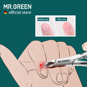 MR.GREEN Stainless-Steel Cuticle Nippers for Manicure & Pedicure – product detail 2